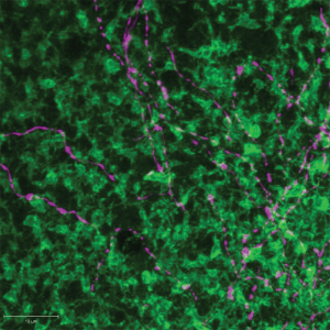 GABAergic amacrine arbor (magenta) overlaid amongst bipolar cell terminals (green)